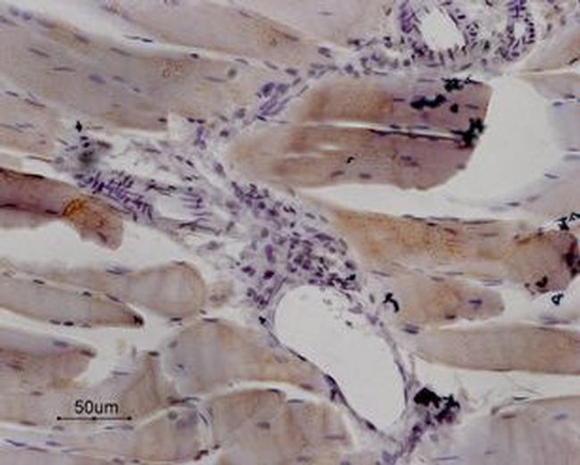 Ryanodine Receptor 1 Antibody in Immunohistochemistry (Paraffin) (IHC (P))