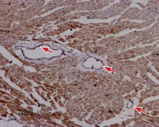 Ryanodine Receptor 2 Antibody in Immunohistochemistry (Paraffin) (IHC (P))