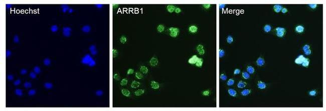 beta Arrestin 1 Antibody in Immunocytochemistry (ICC/IF)