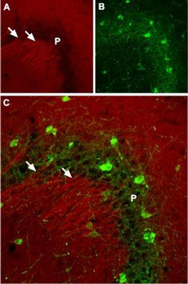 SCN2A (NaV1.2) Antibody in Immunohistochemistry (IHC)