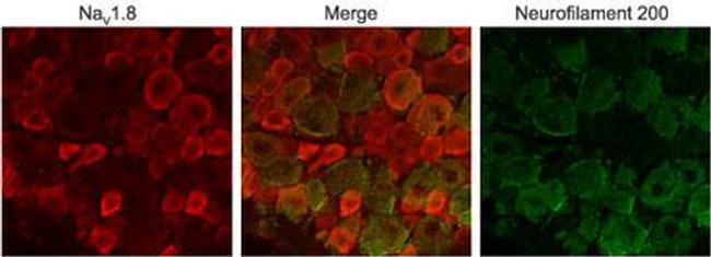 NaV1.8 (SCN10A) Antibody in Immunohistochemistry (IHC)