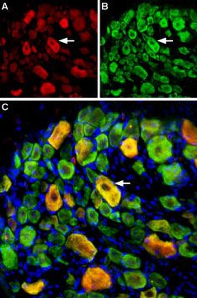 ASIC3 Antibody in Immunohistochemistry (Frozen) (IHC (F))