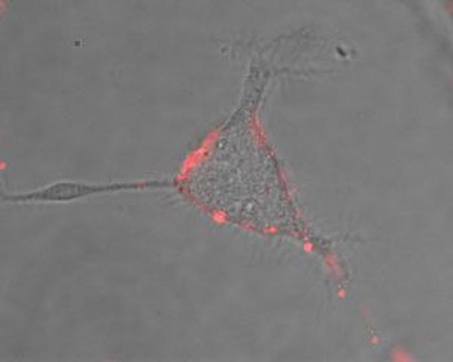 NALCN/VGCNL1 (extracellular) Antibody in Immunocytochemistry (ICC/IF)