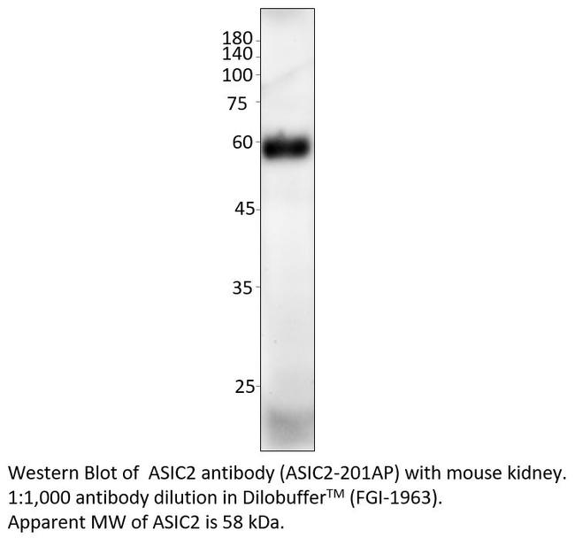 ASIC2 Antibody in Western Blot (WB)