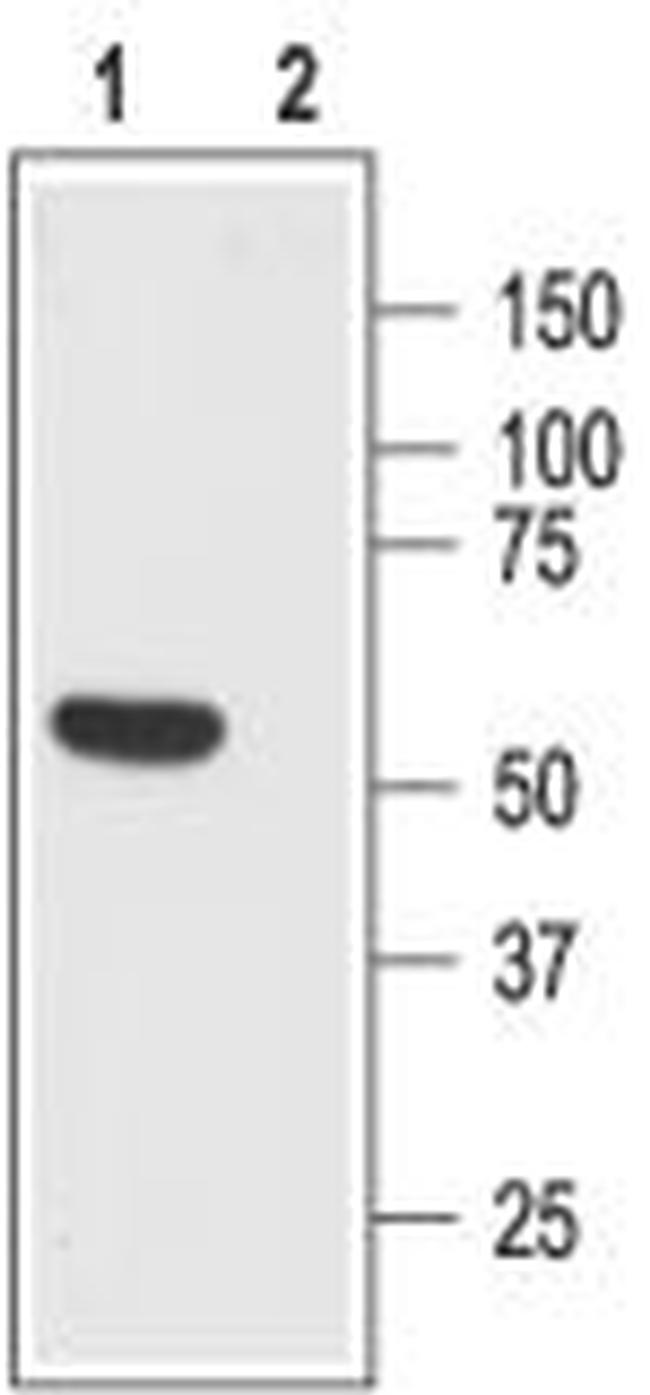 Somatostatin Receptor Type 1 (extracellular) Antibody in Western Blot (WB)