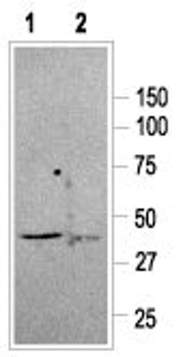 Somatostatin Receptor Type 2 Antibody in Western Blot (WB)