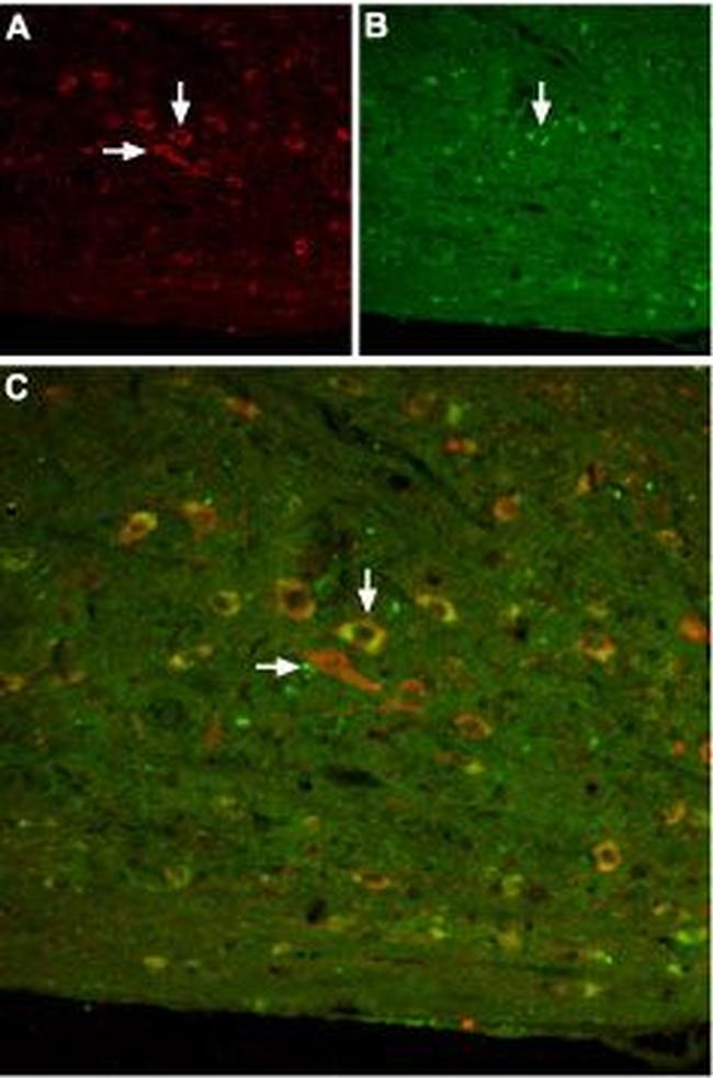 Somatostatin Receptor Type 3 Antibody in Immunohistochemistry (IHC)