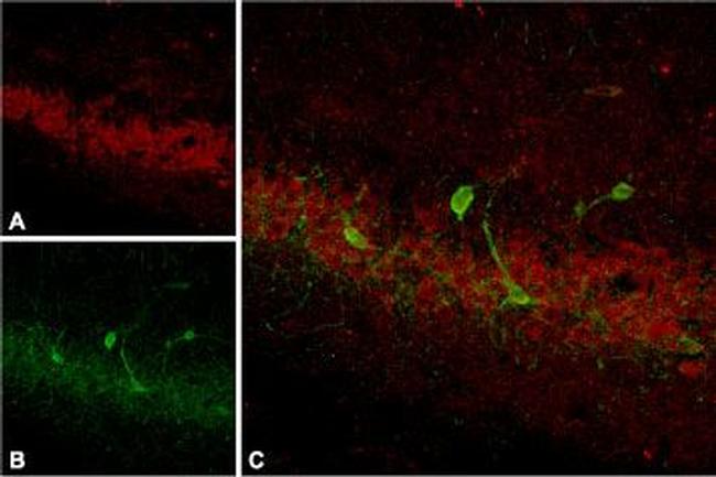 Somatostatin Receptor Type 4 (extracellular) Antibody in Immunohistochemistry (IHC)