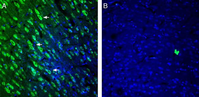 5HT2A Receptor (HTR2A) (extracellular) Antibody in Immunohistochemistry (Frozen) (IHC (F))