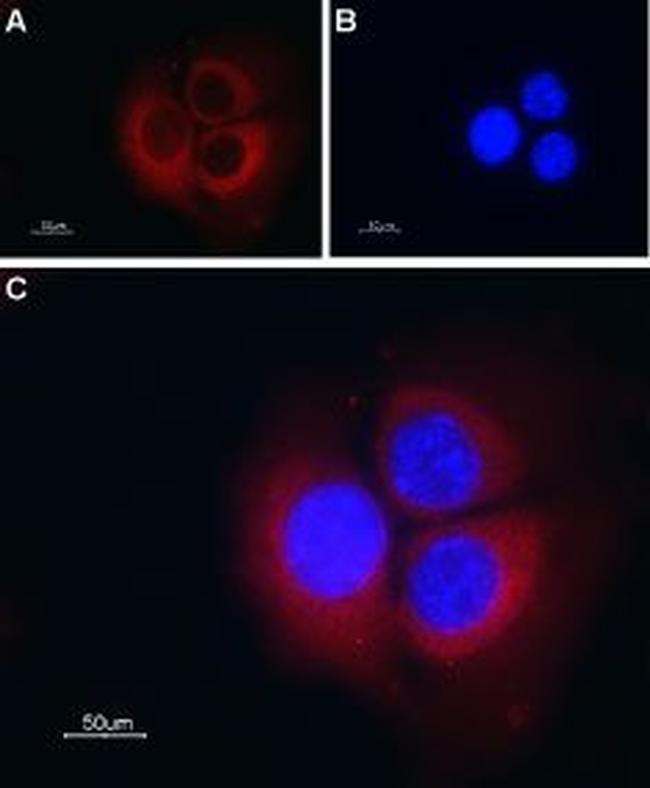 TRIC-B (TMEM38B) Antibody in Immunocytochemistry (ICC/IF)