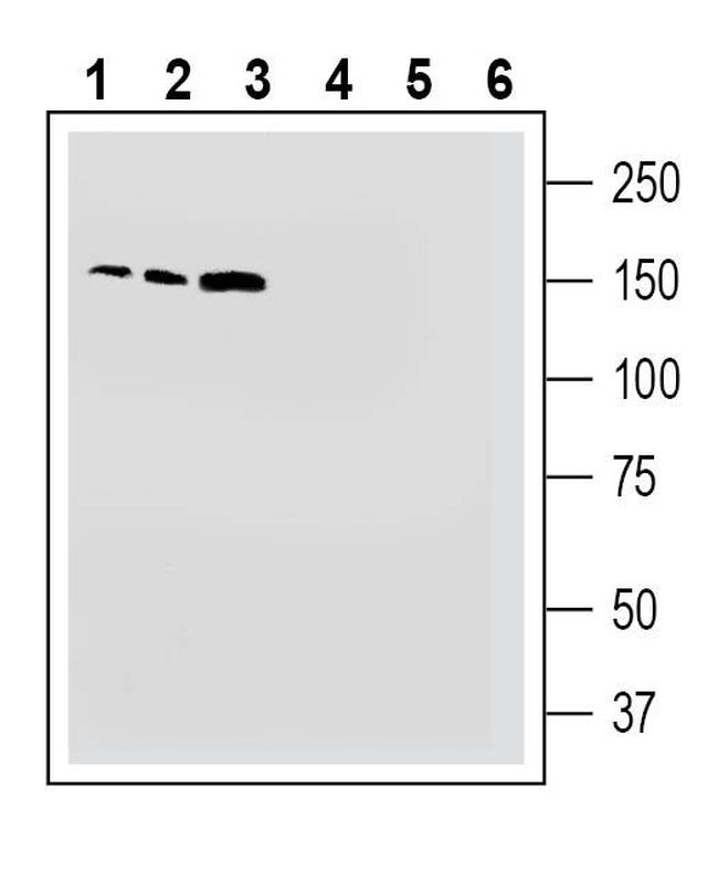 TMC1 (extracellular) Antibody in Western Blot (WB)