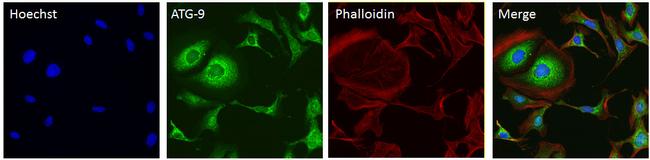 ATG9A Antibody in Immunocytochemistry (ICC/IF)