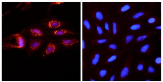 ATG9A Antibody in Immunocytochemistry (ICC/IF)