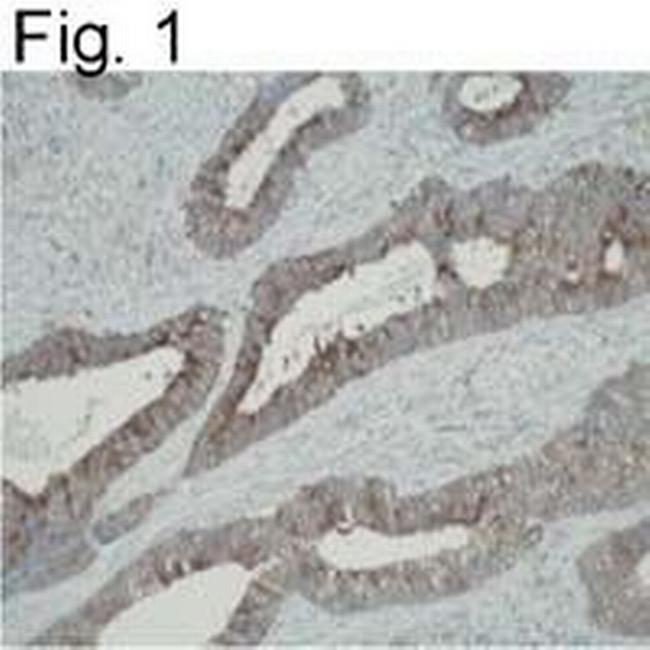 ATIC Antibody in Immunohistochemistry (IHC)