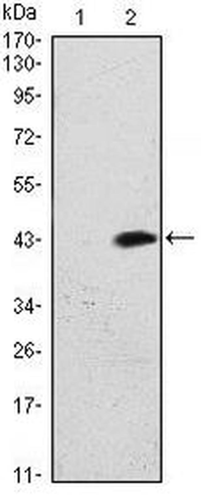 ATM Antibody in Western Blot (WB)