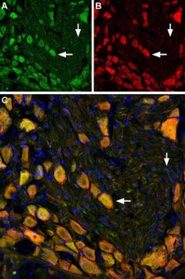 Neurokinin 1 Receptor (NK1R) (extracellular) Antibody in Immunohistochemistry (Paraffin) (IHC (P))