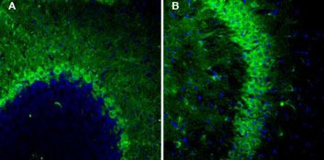 TSH Receptor (TSHR) (extracellular) Antibody in Immunohistochemistry (IHC)