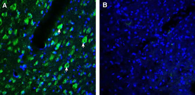 AXL (extracellular) Antibody in Immunohistochemistry (Frozen) (IHC (F))