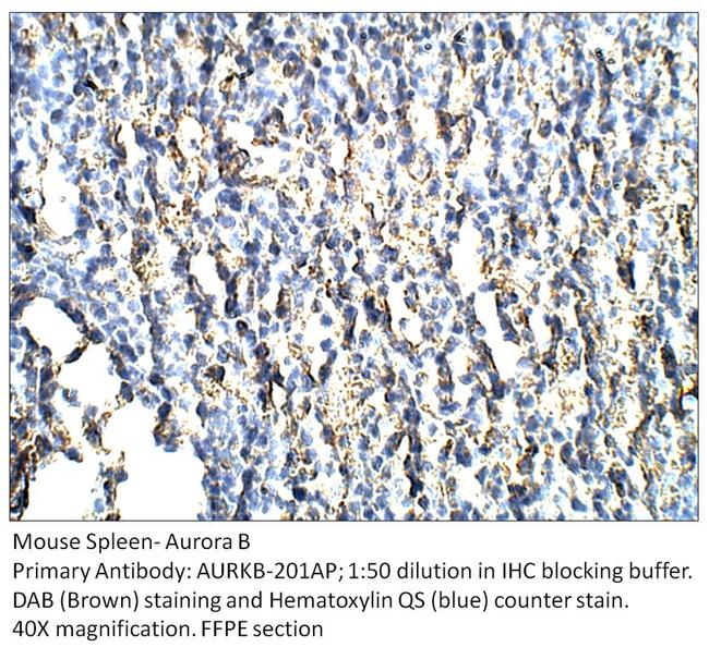 Aurora B Antibody in Immunohistochemistry (IHC)