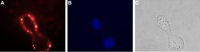 VPAC1 (VIPR1) (extracellular) Antibody in Immunocytochemistry (ICC/IF)