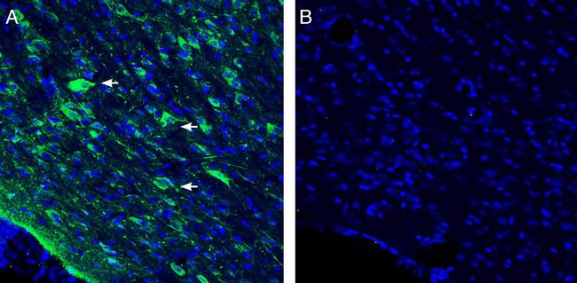 Vasopressin V1A Receptor (AVPR1A) Antibody in Immunohistochemistry (Frozen) (IHC (F))