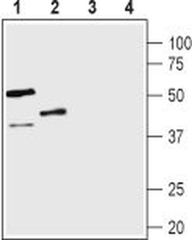 Vasopressin V1B Receptor (AVPR1B) Antibody in Western Blot (WB)