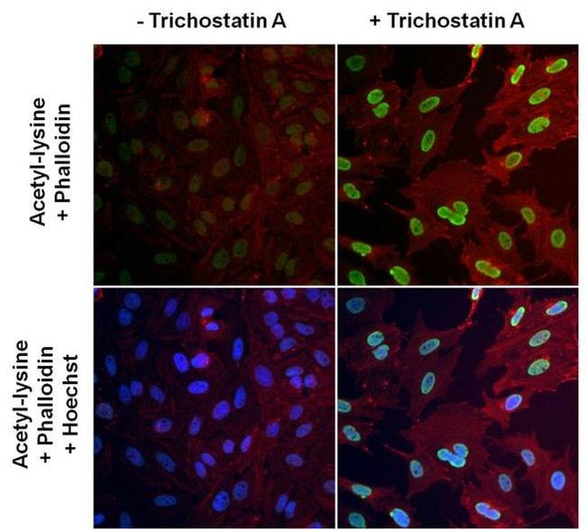 Acetylated Lysine Antibody in Immunocytochemistry (ICC/IF)