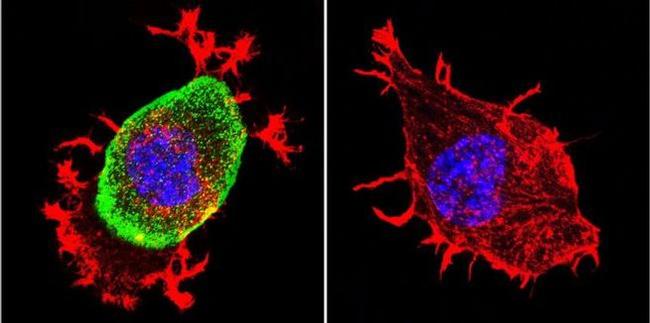 Acetylcholinesterase Antibody in Immunocytochemistry (ICC/IF)