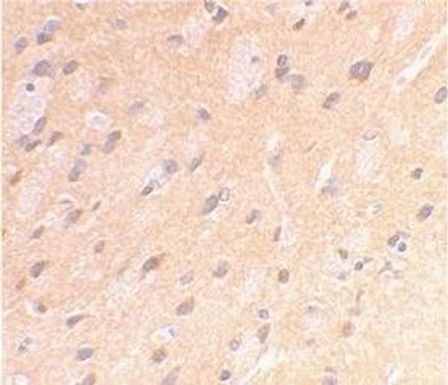 Amyloid Precursor Protein Antibody in Immunohistochemistry (Paraffin) (IHC (P))