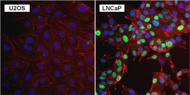 Androgen Receptor Antibody in Immunocytochemistry (ICC/IF)