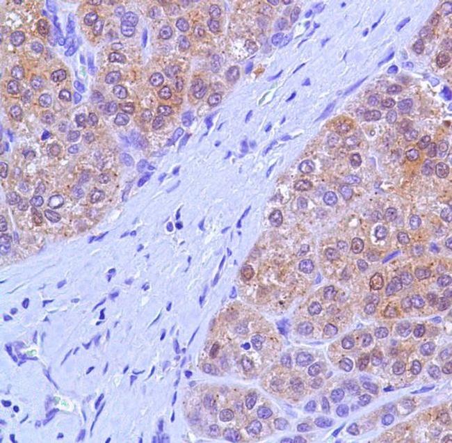 Arginase 1 Antibody in Immunohistochemistry (Paraffin) (IHC (P))