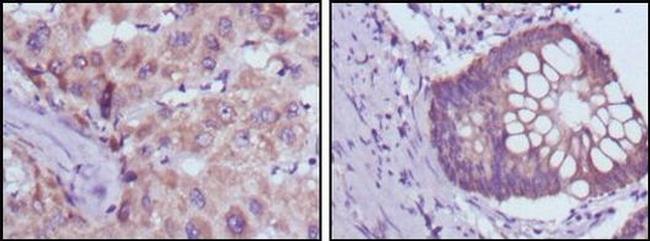 BDH1 Antibody in Immunohistochemistry (Paraffin) (IHC (P))