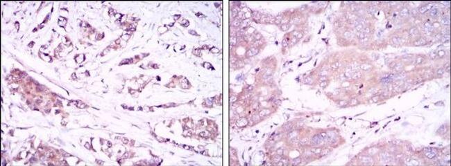 Beclin 1 Antibody in Immunohistochemistry (Paraffin) (IHC (P))