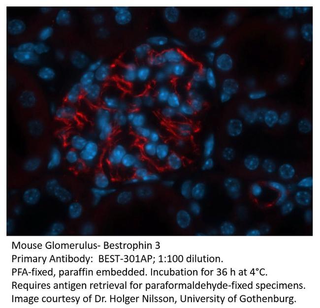 Bestrophin 3 Antibody in Immunohistochemistry (Paraffin) (IHC (P))