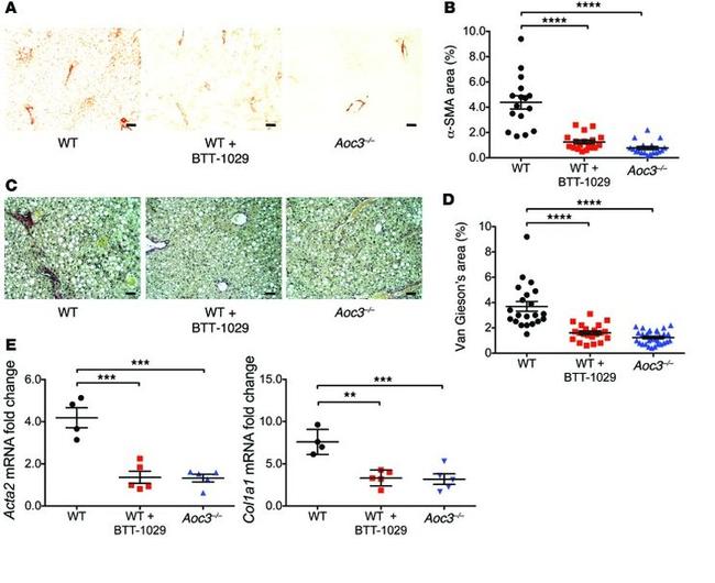 VAP-1 Antibody in Immunohistochemistry (IHC)