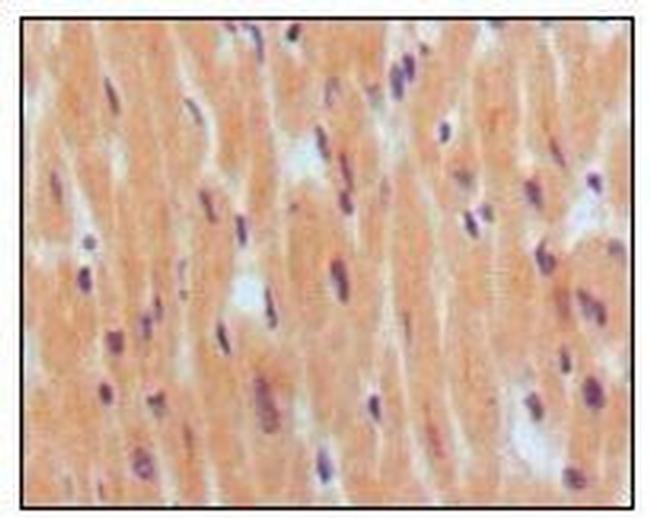 BNP Antibody in Immunohistochemistry (Paraffin) (IHC (P))