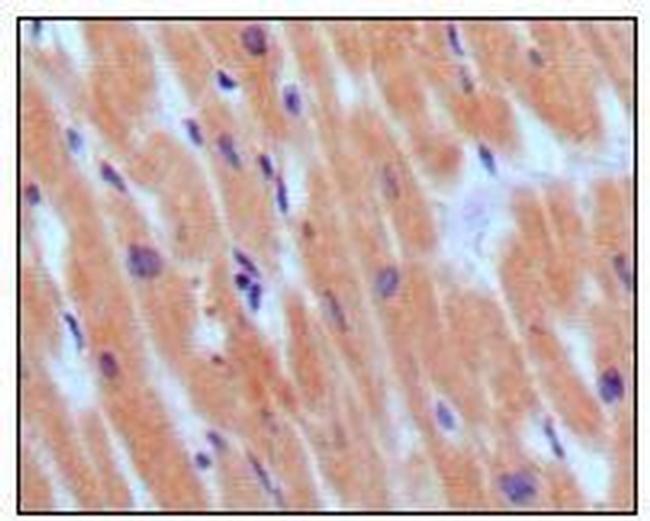 BNP Antibody in Immunohistochemistry (Paraffin) (IHC (P))