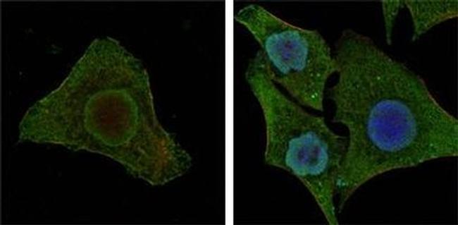 B-Raf Antibody in Immunocytochemistry (ICC/IF)