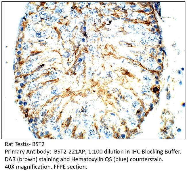 BST2 Antibody in Immunohistochemistry (IHC)