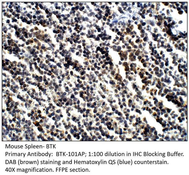 BTK Antibody in Immunohistochemistry (IHC)