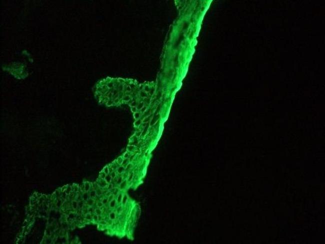 Cytokeratin 1 Antibody in Immunohistochemistry (Frozen) (IHC (F))