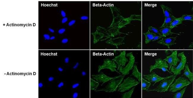 beta Actin Antibody in Immunocytochemistry (ICC/IF)