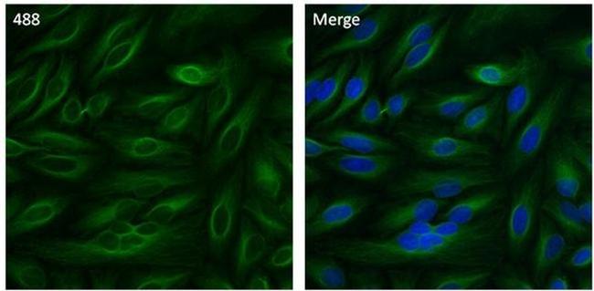 beta Tubulin Antibody in Immunocytochemistry (ICC/IF)