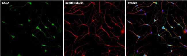 beta Tubulin Antibody in Immunocytochemistry (ICC/IF)