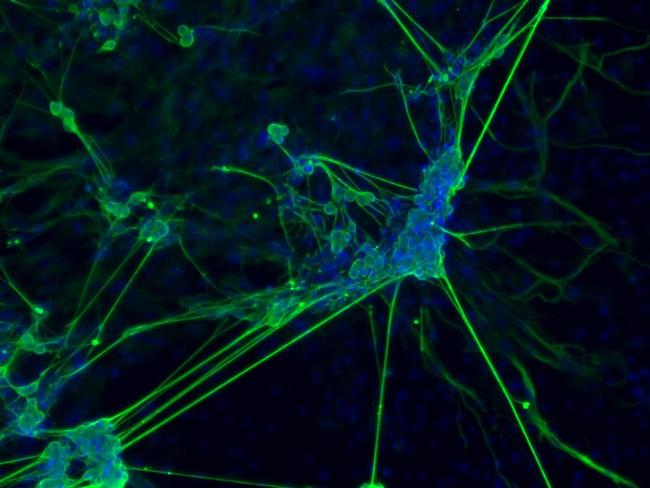 beta-3 Tubulin Antibody in Immunocytochemistry (ICC/IF)