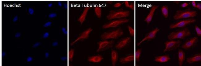 beta Tubulin Antibody in Immunocytochemistry (ICC/IF)