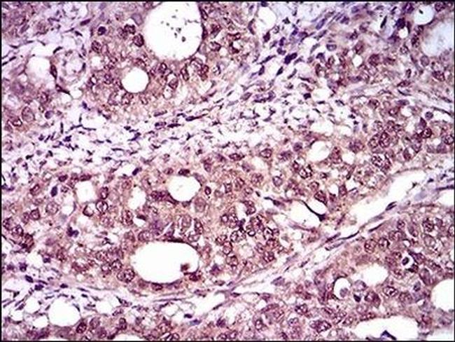 Brachyury Antibody in Immunohistochemistry (Paraffin) (IHC (P))