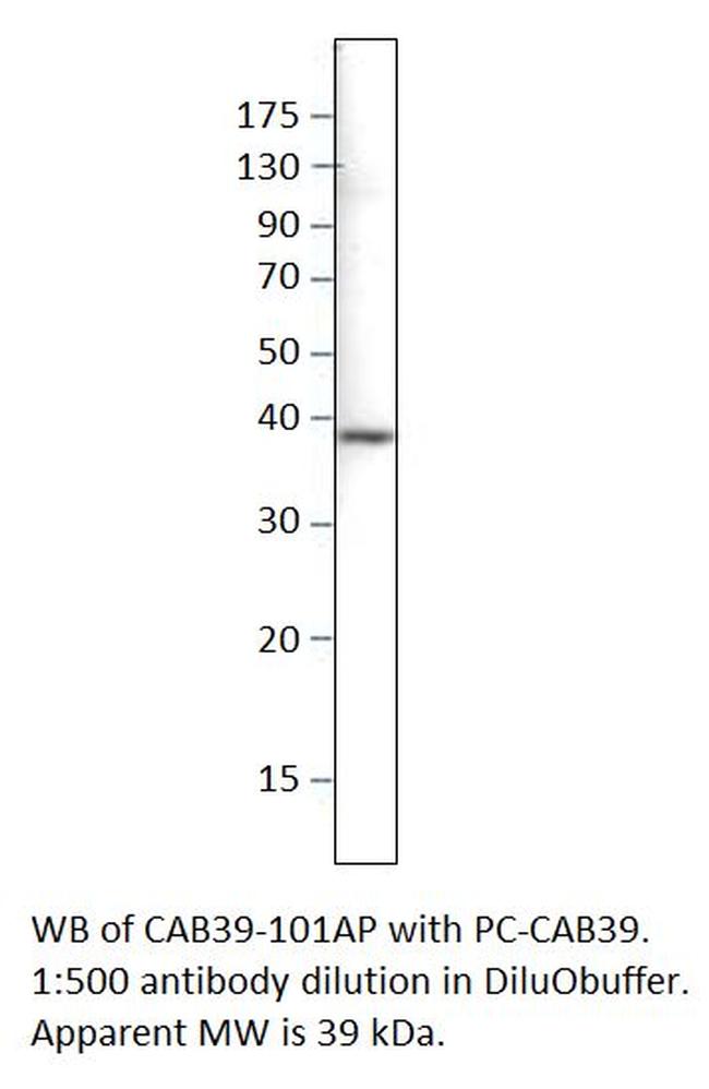 CAB39 Antibody in Western Blot (WB)