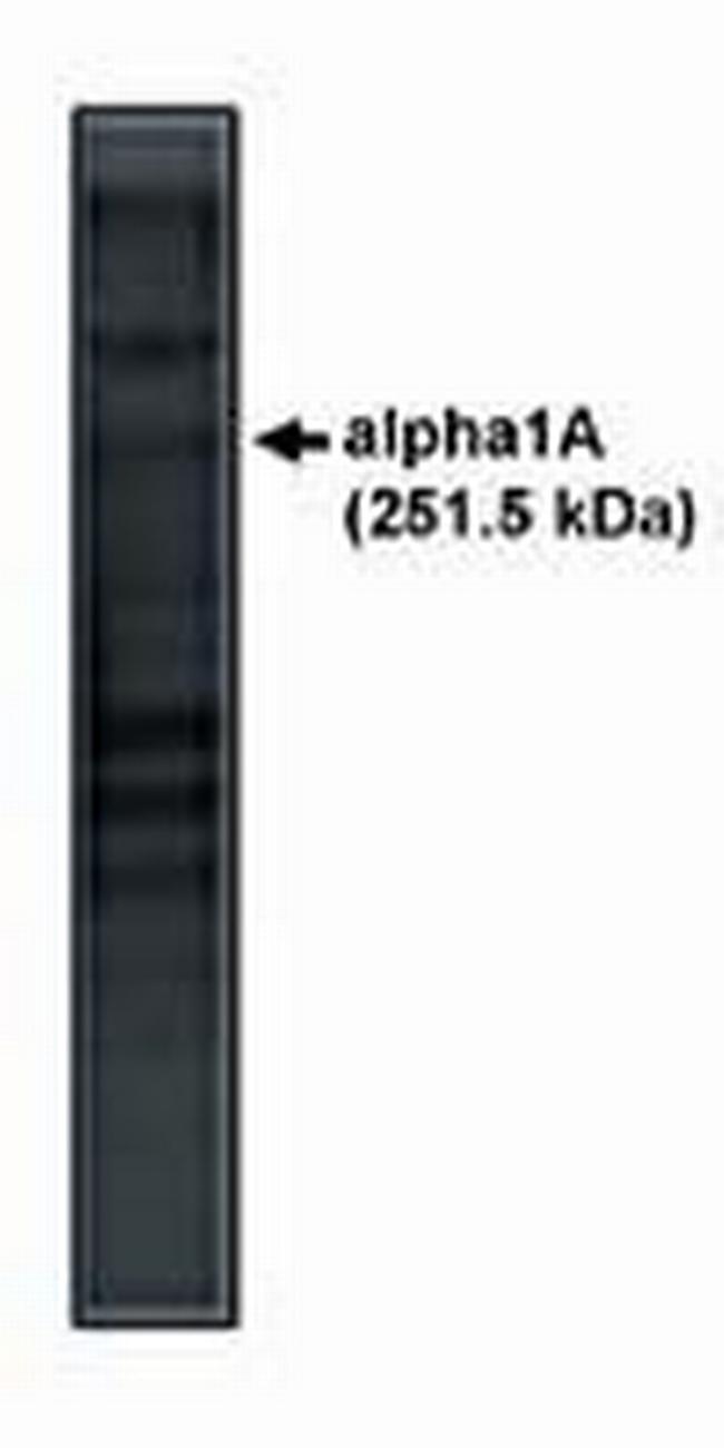 CaV2.1 Antibody in Western Blot (WB)