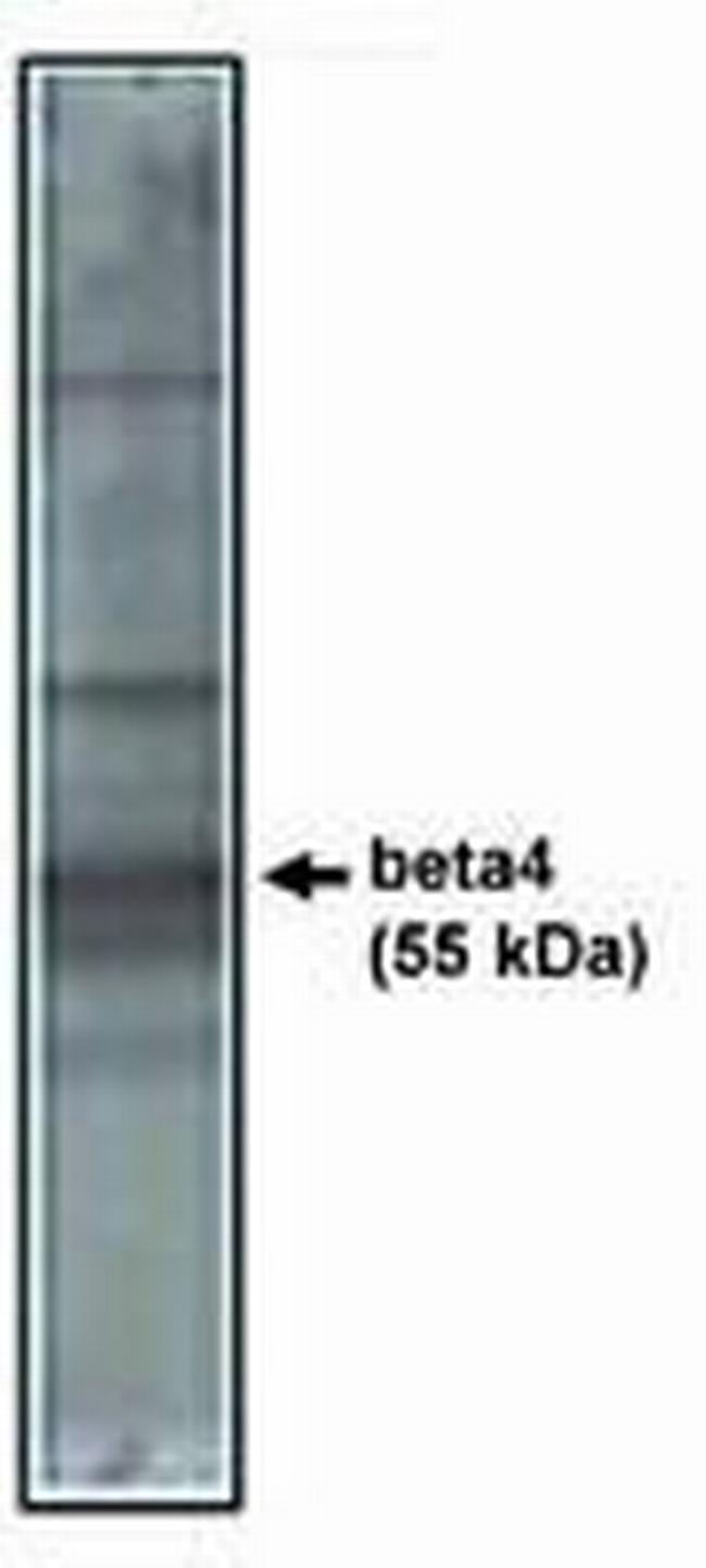 Calcium Channel beta-4 Antibody in Western Blot (WB)